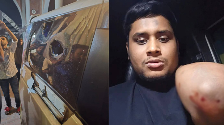 হামলার আগে দীর্ঘক্ষণ অনুসরণ করা হচ্ছিল হাসনাতকে হামলার আগে দীর্ঘক্ষণ অনুসরণ করা হচ্ছিল হাসনাতকে