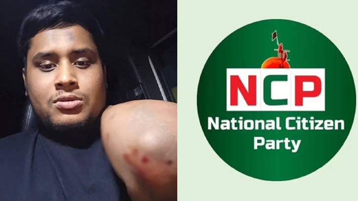 হাসনাতের ওপর হামলার প্রতিবাদে বিক্ষোভ, ২৪ ঘণ্টার আল্টিমেটাম এনসিপির হাসনাতের ওপর হামলার প্রতিবাদে বিক্ষোভ, ২৪ ঘণ্টার আল্টিমেটাম এনসিপির