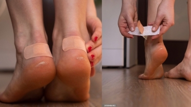 নতুন জুতা পরে পায়ে ফোসকা? এড়ানোর ঘরোয়া উপায়
