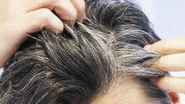 অকালে চুল পাকা রোধে করণীয়