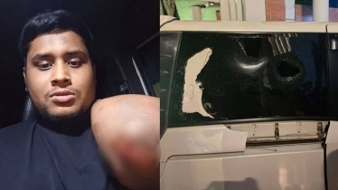 হাসনাতের গাড়িবহরে হামলা: মামলা ১০০ জনের বিরুদ্ধে