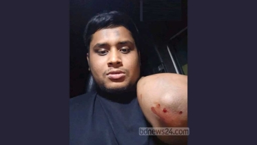 হাসনাতের গাড়িবহরে হামলা: মামলা ১০০ জনের বিরুদ্ধে