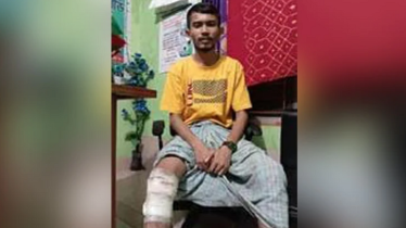 উন্নত চিকিৎসা না পেয়ে পঙ্গুত্বের শঙ্কায় দিন কাটছে বেল্লালের