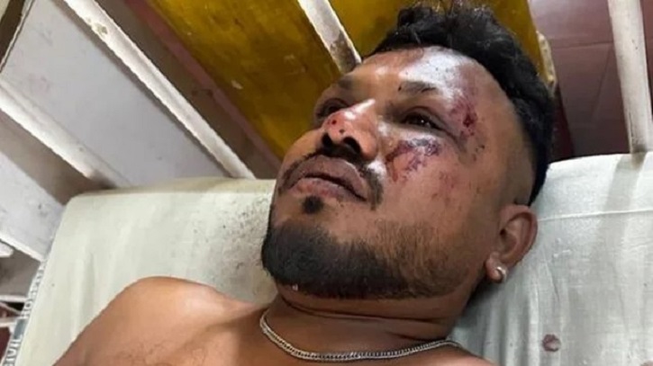 আহমেদাবাদ-লন্ডন ফ্লাইট বিধ্বস্ত, নিহত প্রায় সবাই; বেঁচে গেলেন রমেশ আহমেদাবাদ-লন্ডন ফ্লাইট বিধ্বস্ত, নিহত প্রায় সবাই; বেঁচে গেলেন রমেশ