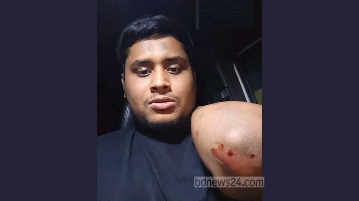 হাসনাতের গাড়িবহরে হামলা: মামলা ১০০ জনের বিরুদ্ধে হাসনাতের গাড়িবহরে হামলা: মামলা ১০০ জনের বিরুদ্ধে