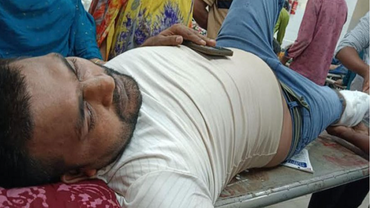 জেনেভা ক্যাম্পে ফের সংঘর্ষ, মাছ ব্যবসায়ীকে কুপিয়ে গুরুতর জখম