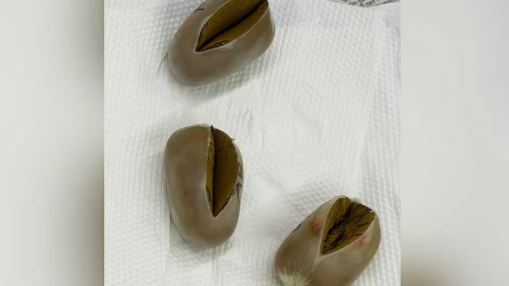 শাহজালালে যাত্রীর পায়ুপথে তিনটি ‘সোনার ডিম’